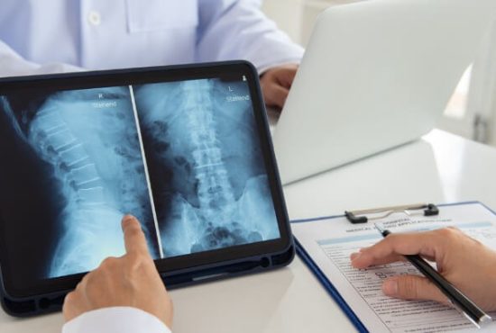  Signs You Need Back Surgery
