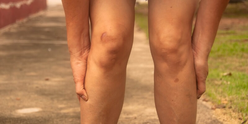 Knee Crepitus