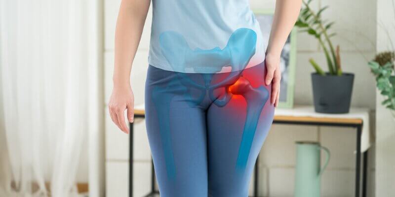 Hip Arthritis Treatment