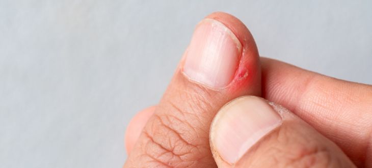  Why Does My Finger Hurt?