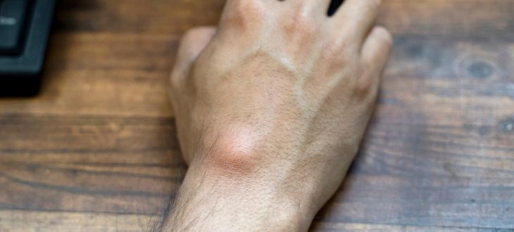  Why Does My Hand Hurt?